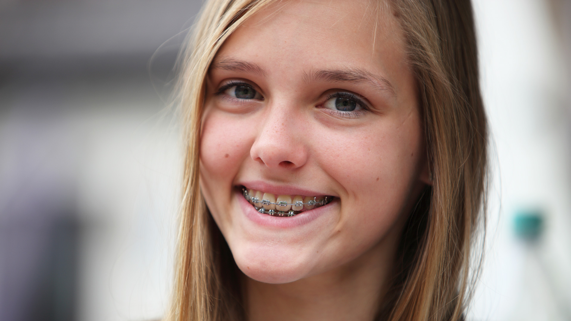 Orthodontic Teeth Whitening in Houston TX